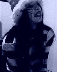 Scars